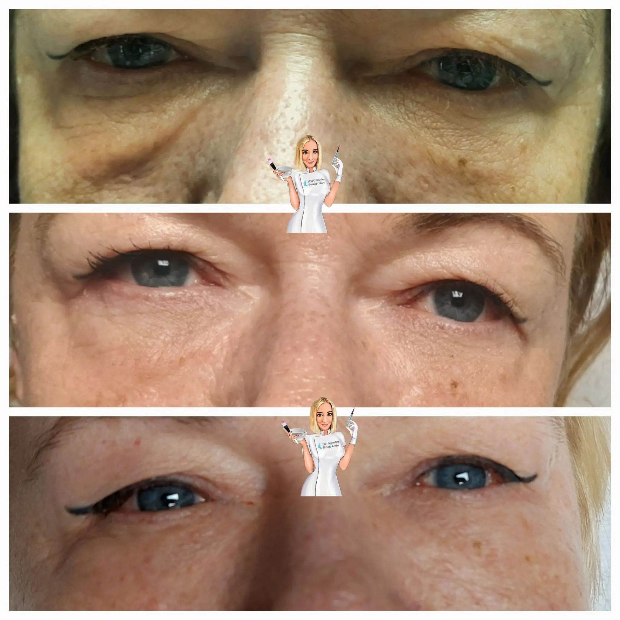 Efekt zabiegu przed i po