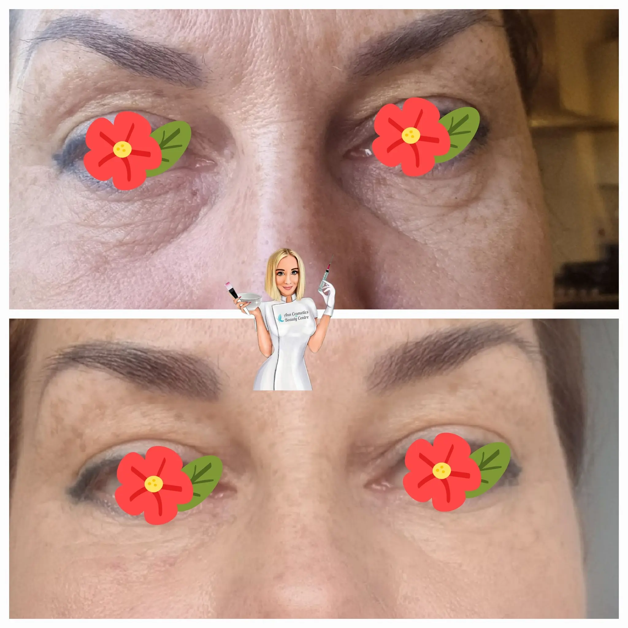 Efekt zabiegu przed i po